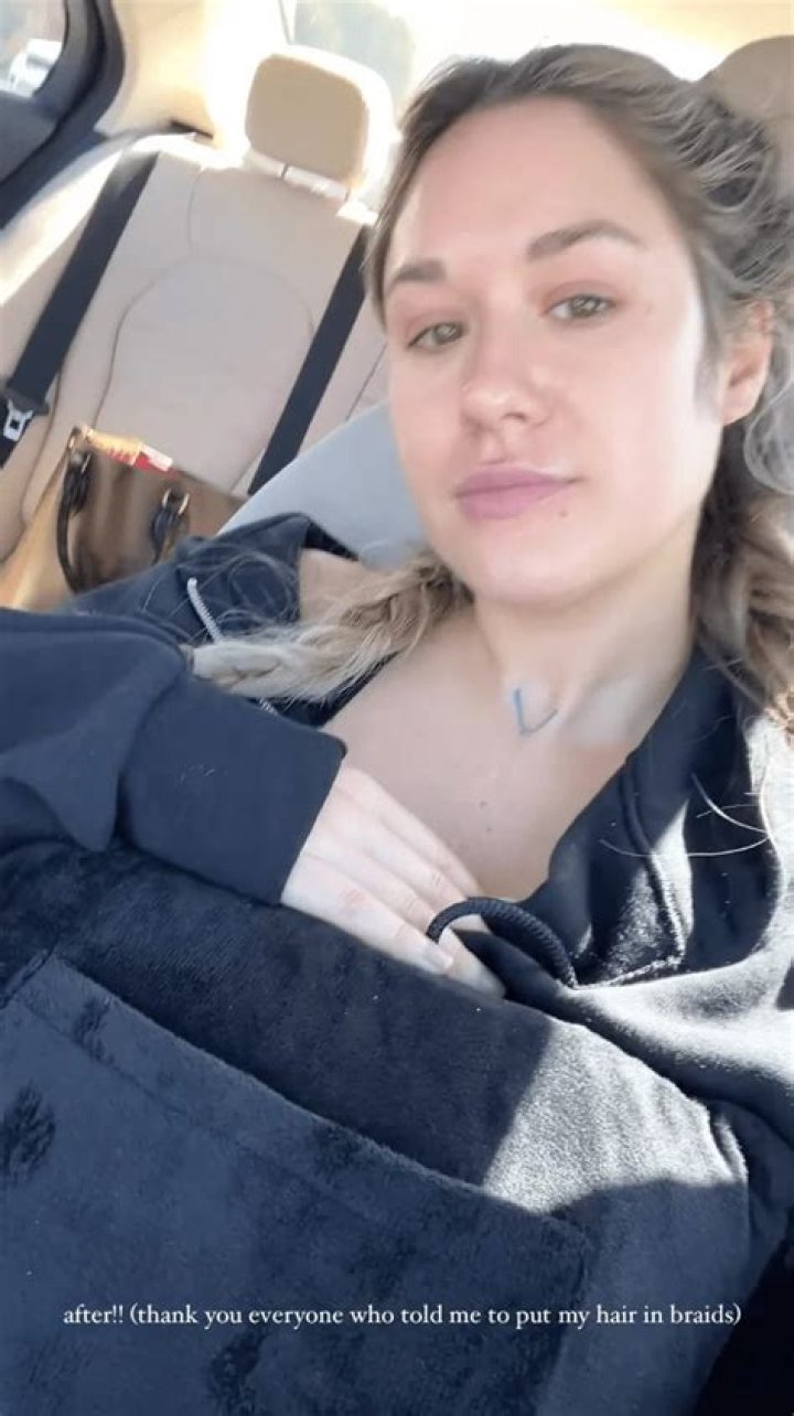 Bachelorette’s Rachel Recchia Undergoes Breast Reduction Surgery: ‘I Did It’