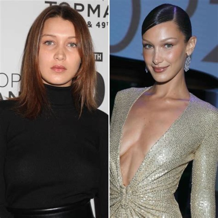 Bella Hadid Clarifies Which Plastic Surgery Procedures She Received: See Her Transformation Photos