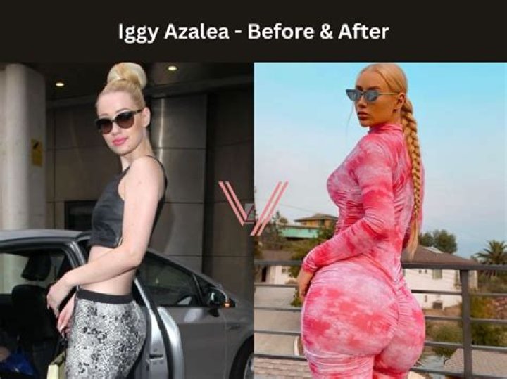 Bow Wow Falls For Iggy Azalea's Thirst Trap