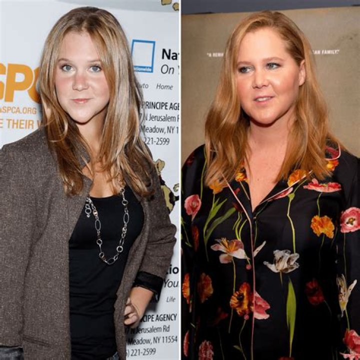 Comedian Amy Schumer’s Transformation Over the Years: Photos of Her Then vs. Now