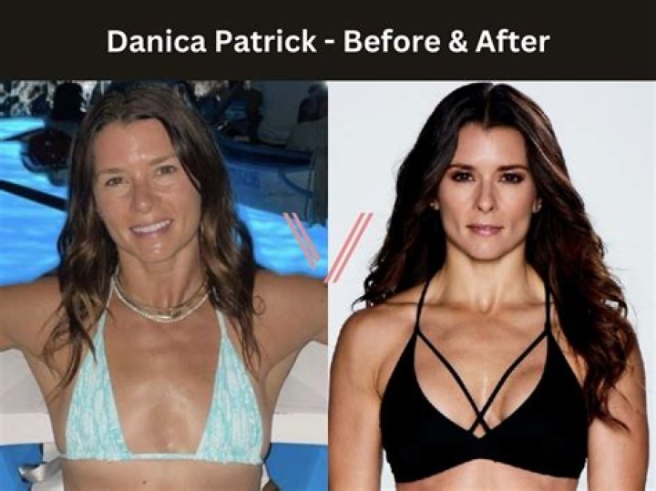 Danica Patrick Reveals She Had Breast Implants Removed After Suffering Numerous Health Issues