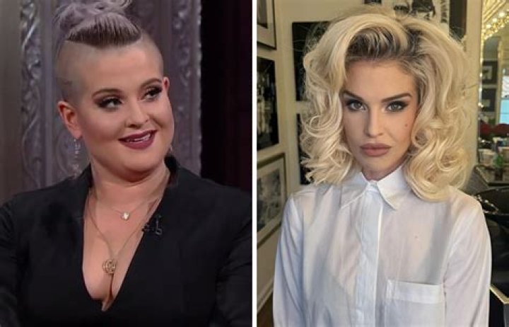 Did Kelly Osbourne Get Plastic Surgery? What She’s Said About Going Under the Knife