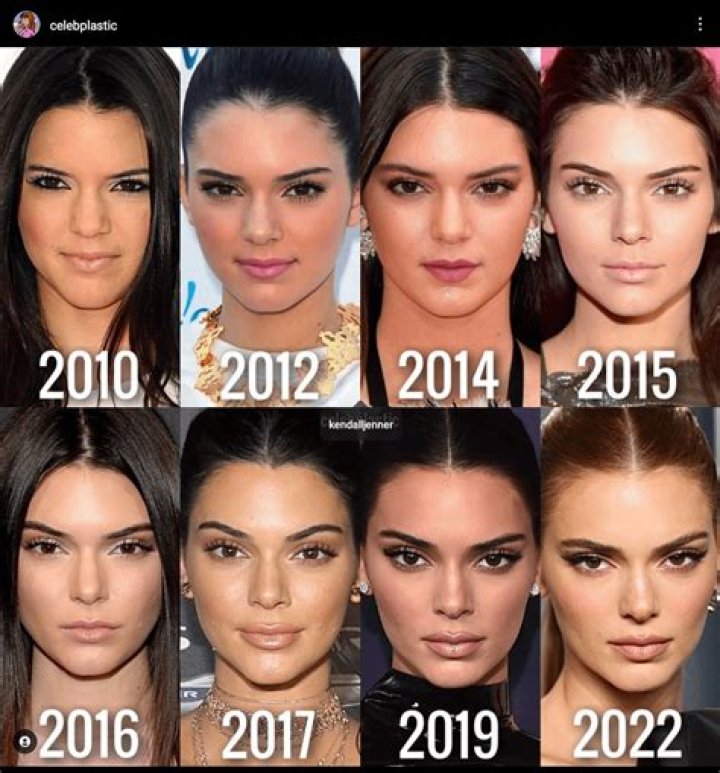 Did Kendall Jenner Get a Boob Job? She Sparks Plastic Surgery Rumors