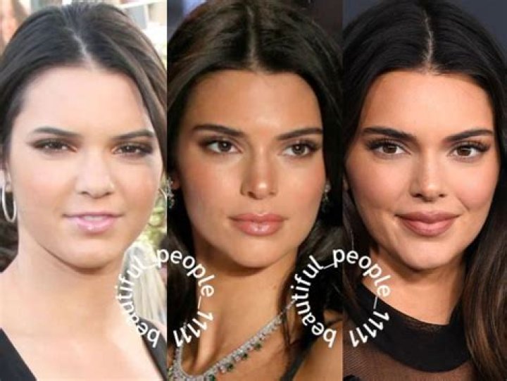 Did Kendall Jenner have braces? – Celebrity.fm – #1 Official Stars, Business & People Network, Wiki, Success story, Biography & Quotes