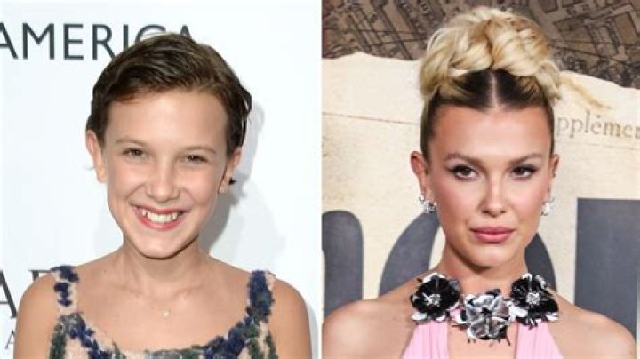 Did Millie Bobby Brown Get Plastic Surgery? Transformation Photos From ‘Stranger Things’ to Now