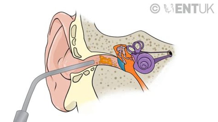 Everything On BBC’s Hywel Griffiths Face and Skin Condition – Does Hywel Griffith Have A Cancer?