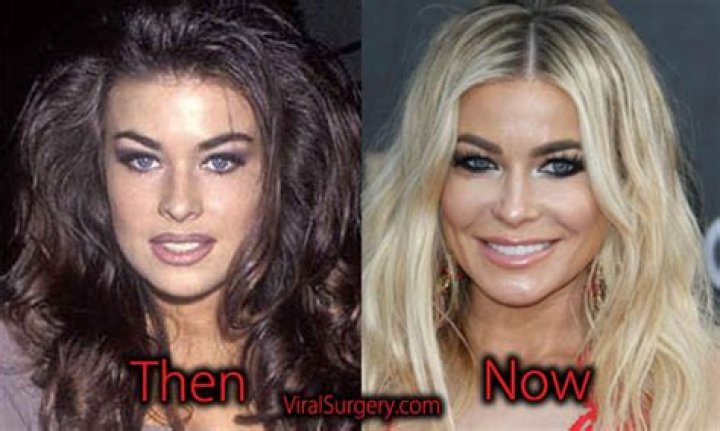 Has Carmen Electra Had Plastic Surgery? Everything She Has Admitted to About Going Under the Knife