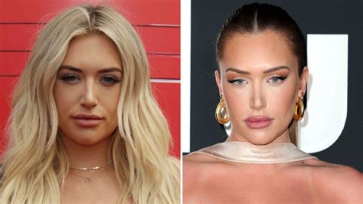 Has Stassie Karanikolaou Gone Under the Knife? See Transformation Photos, Quotes on Plastic Surgery