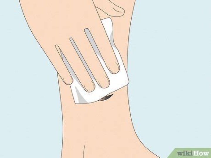 How to take off saniderm