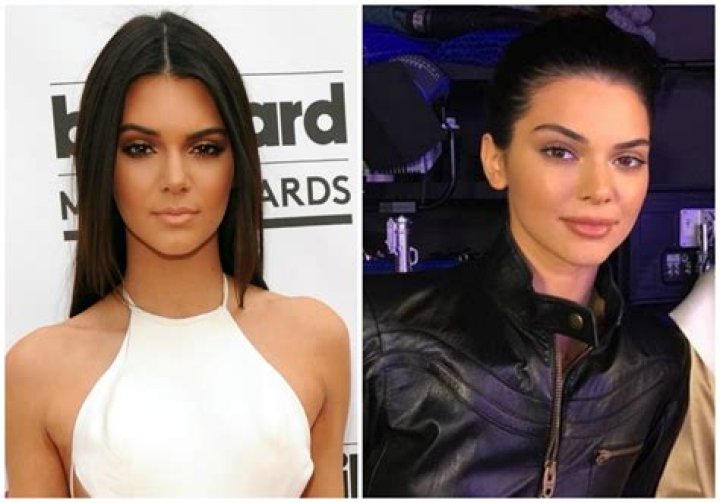 Kendall Jenner Before and After: See the Pics That Have Fans Speculating Plastic Surgery