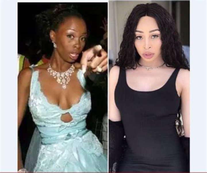 Khanyi Mbau Before And After Plastic Surgery, Age Height And Body Measurements
