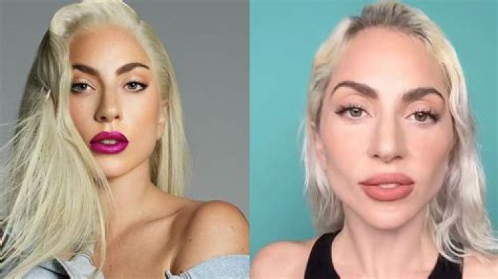 Lady Gaga’s Weight Loss: Fans Think She Got Skinny By Using Ozempic!