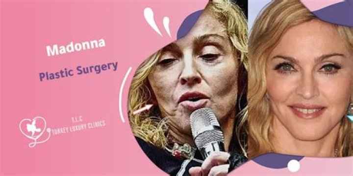 Madonna Slams Plastic Surgery Rumors! See the Material Girl’s Transformation From the ’80s to Today
