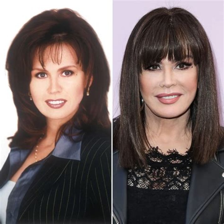 Marie Osmond Fans Accuse Her of Plastic Surgery: ‘You Look Like Kim Kardashian’: Transformation Photos