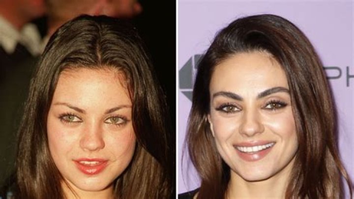Mila Kunis’ Transformation Over the Years: Then and Now Photos