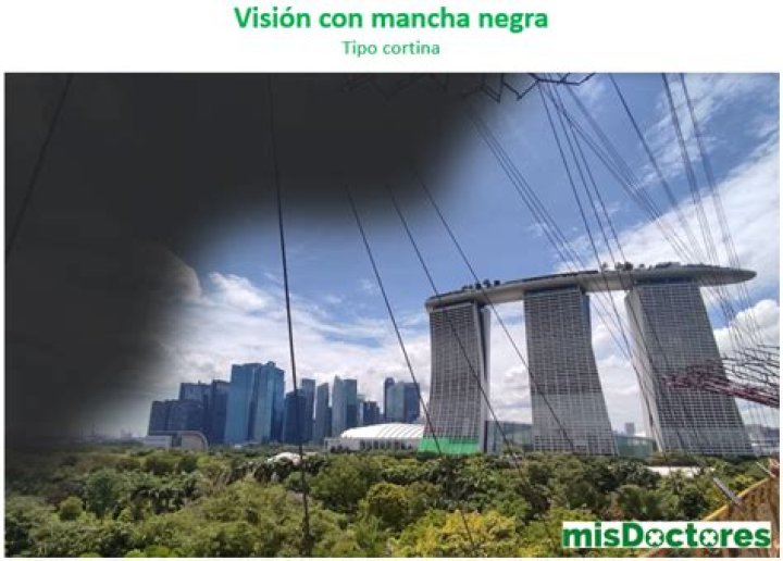 ¿Por qué hay una sombra oscura en mi televisor? – Celebrity.fm