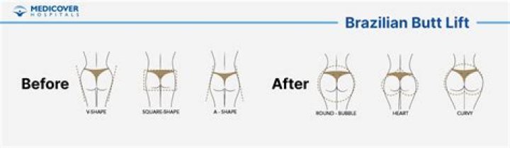 Sukihana Before Plastic Surgery: How Was She Prior to Breast Augmentation, Brazilian Butt Lift & Veneers?