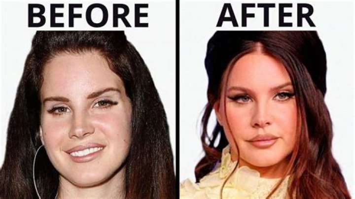 Who Is Gigi De Lana Surgery Doctor? Before And After Pictures