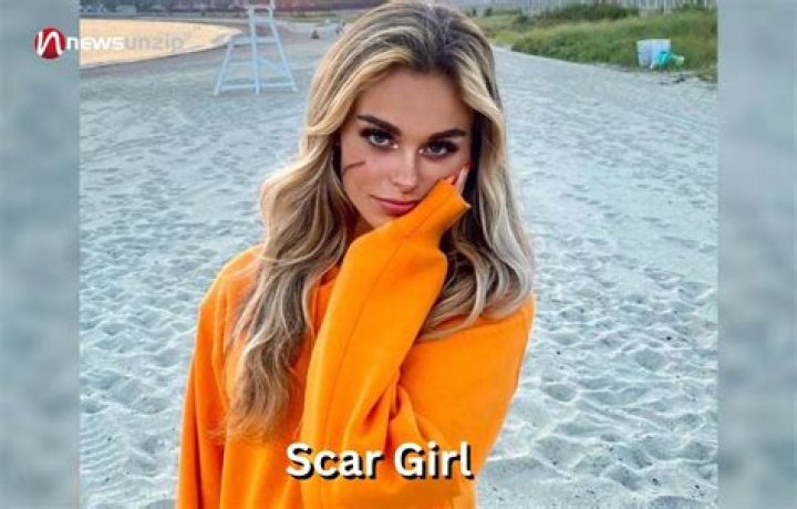 Who is Scar Girl? Wiki, Age, Height, Boyfriend, Family, Net Worth, Biography & More