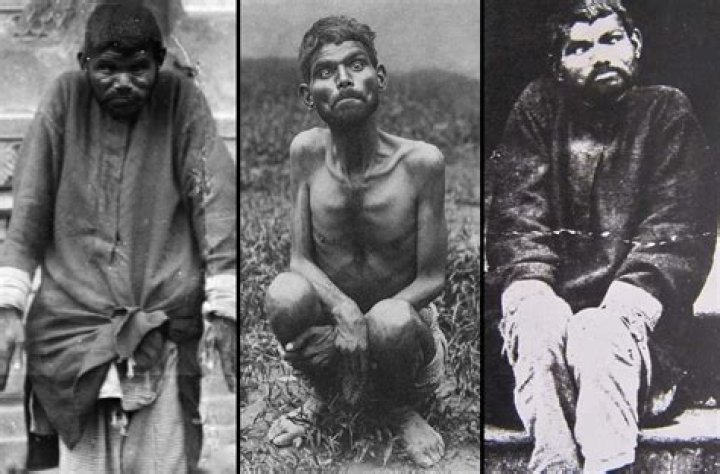 Who Is Zanziman Ellie? Real Life Mowgli -Where Is He Now? Details To Know